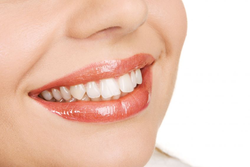 How Dental Veneers Can Help Correct Slight Imperfections with Your Teeth