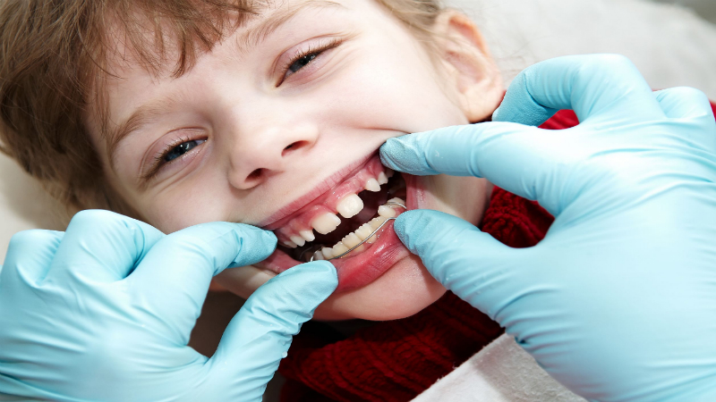 Children’s Dentist In Castle Hill: Advantages