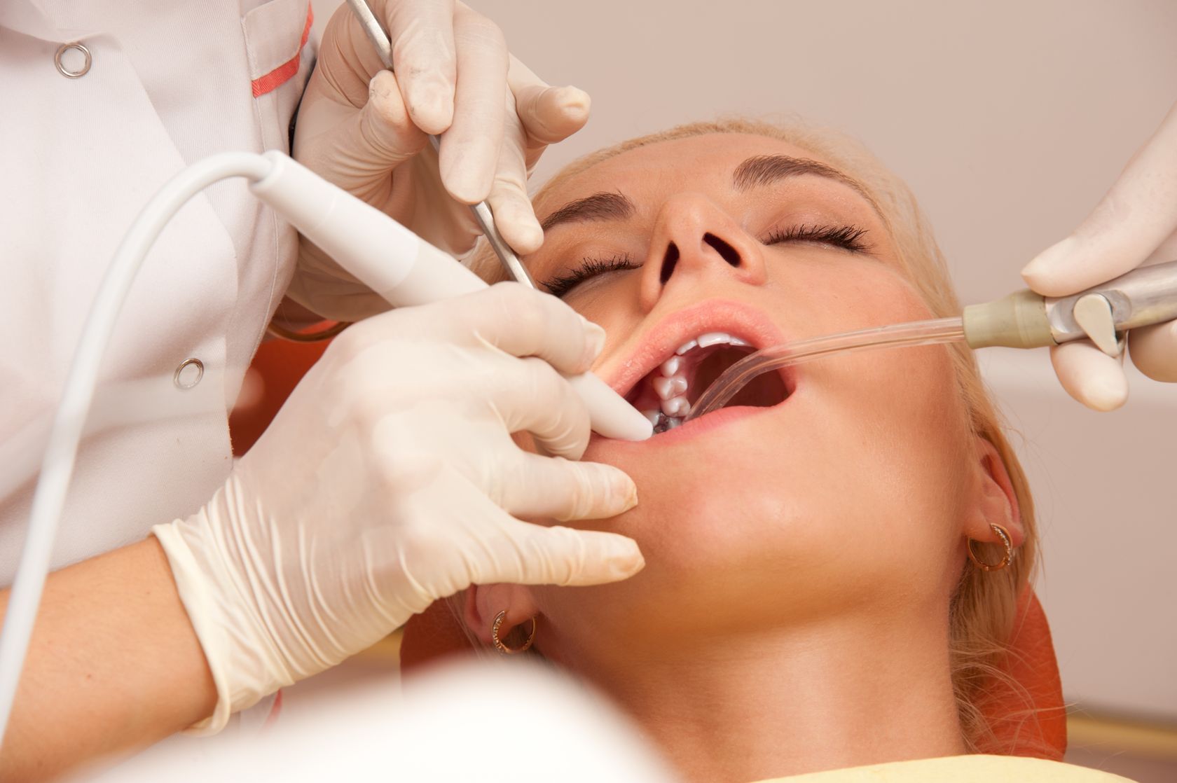 When a Broken Tooth Requires an Emergency Dentist in Long Beach, CA