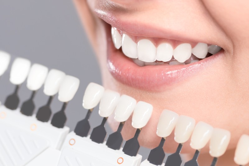 Three Types of Affordable Cosmetic Dentistry in HI