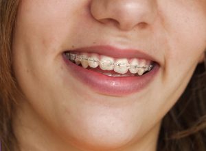 What Kinds of Services and Treatments Does an Orthodontist Provide?